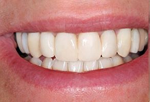 Santa Clara Dental