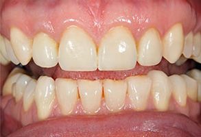 Santa Clara Dental