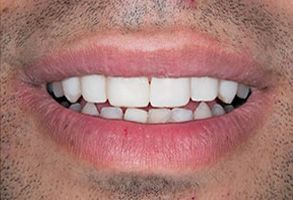 Santa Clara Dental