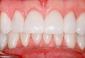 Santa Clara Dental