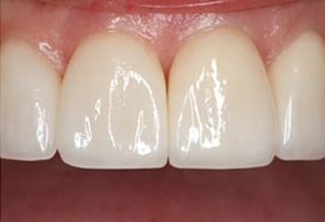 Santa Clara Dental