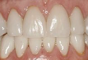 Santa Clara Dental