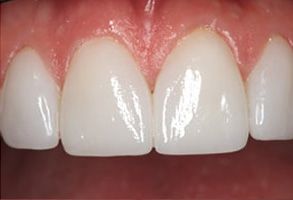 Santa Clara Dental