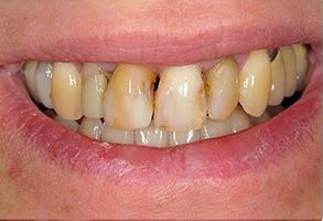 Santa Clara Dental