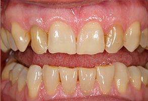 Santa Clara Dental