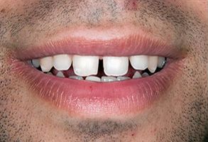 Santa Clara Dental