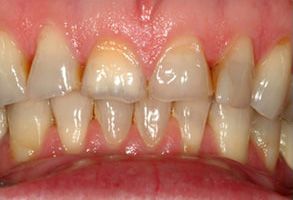 Santa Clara Dental