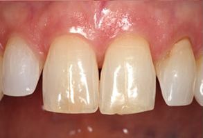Santa Clara Dental