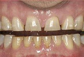Santa Clara Dental