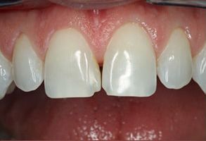 Santa Clara Dental